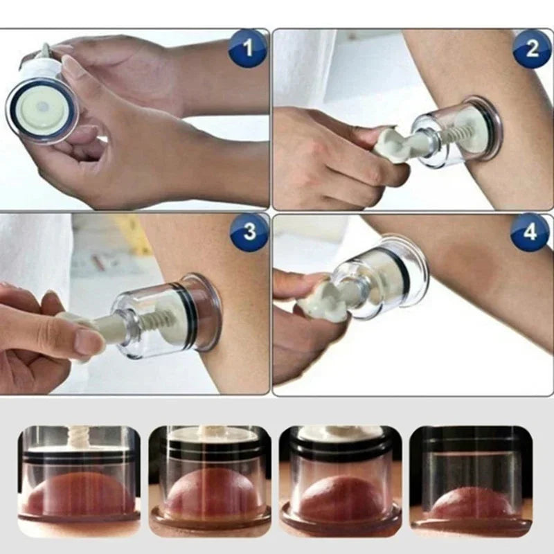 Vacuum Suction Cupping Cup, Nipple Enhancer Massage Vacuum Cans Plastic Enlarger Suction Enlarger Body Breast Massager Cups